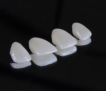 Slider image (2) Neo Dental Clinic